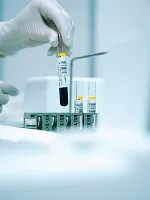 Rapid Tests