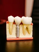 Dentistry